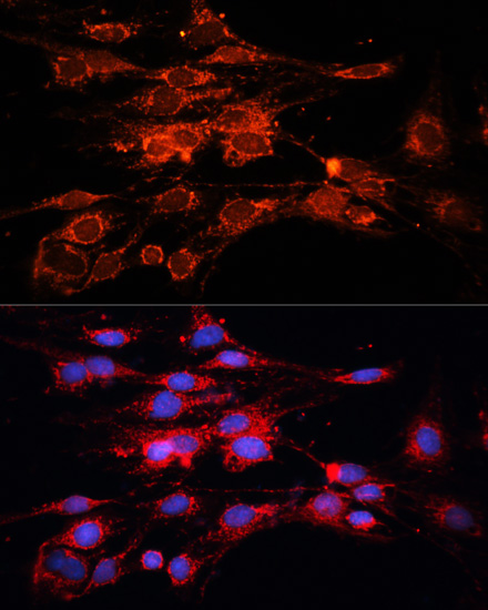 Anti-RAB7A Antibody (CAB12784)