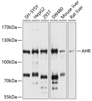 Anti-AHR Antibody (CAB1451)