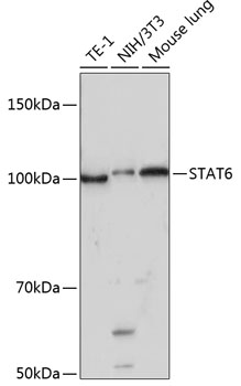 Anti-STAT6 Antibody (CAB19120)