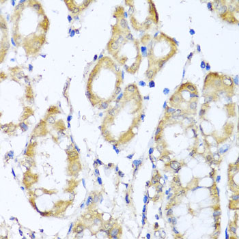 Anti-KCND2 Antibody (CAB6203)