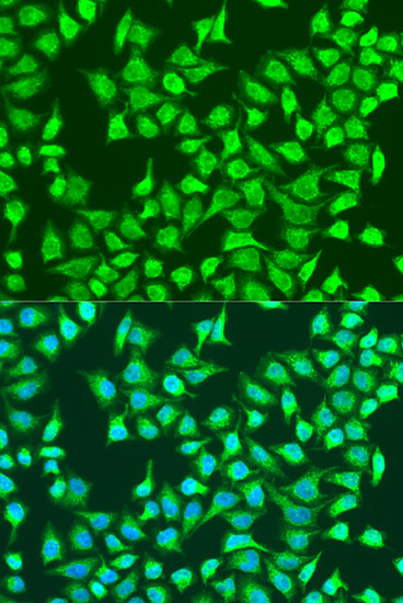 Anti-SIRT4 Antibody (CAB15800)