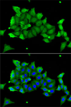 Anti-CA1 Antibody (CAB1031)