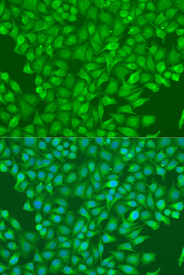 Anti-CBL Antibody (CAB0732)