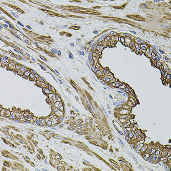 Anti-FLNB Antibody (CAB2481)