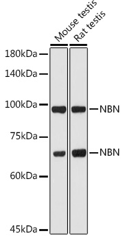 Anti-NBN Antibody [KO Validated] (CAB0783)