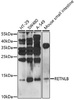 Anti-RETNLB Antibody (CAB17228)