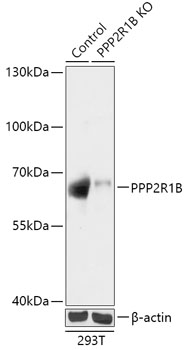 Anti-PPP2R1B Antibody [KO Validated] (CAB18089)