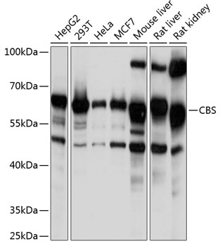 Anti-CBS Antibody (CAB1427)