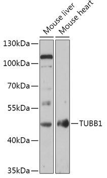 Anti-TUBB1 Antibody (CAB17779)