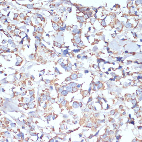 Anti-COX5A Antibody (CAB6437)