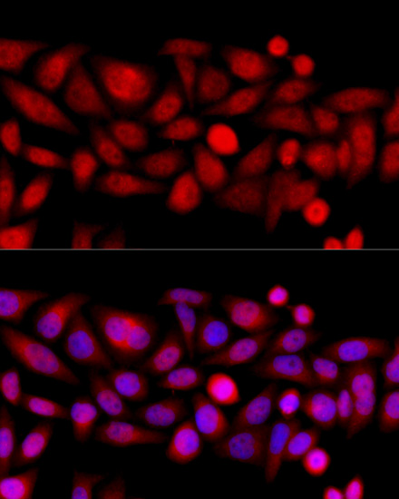 Anti-KIF4A Antibody (CAB10193)