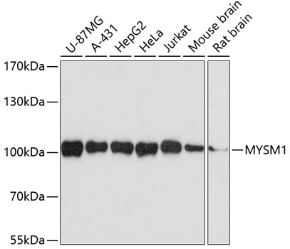 Anti-MYSM1 Antibody (CAB3102)