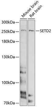 Anti-SETD2 Antibody (CAB11271)