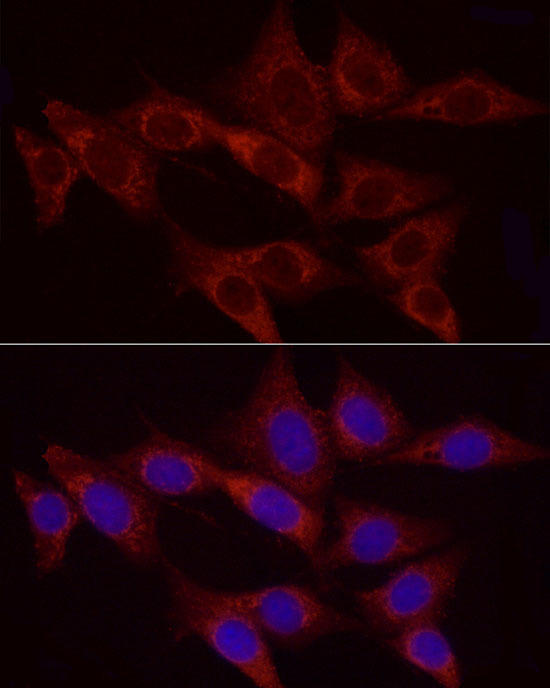 Immunofluorescence analysis of NIH/3T3 cells using [KO Validated] Hexokinase II Rabbit mAb at dilution of 1:50 (40x lens). Blue: DAPI for nuclear staining.