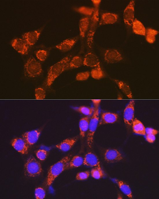 Anti-NDUFV1 Antibody (CAB13333)