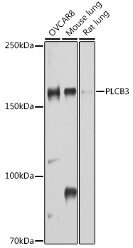 Anti-PLCB3 Antibody (CAB10236)