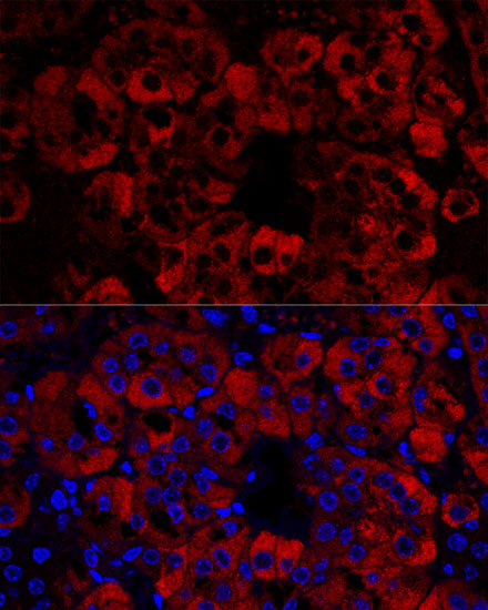 Anti-STAR Antibody (CAB16432)