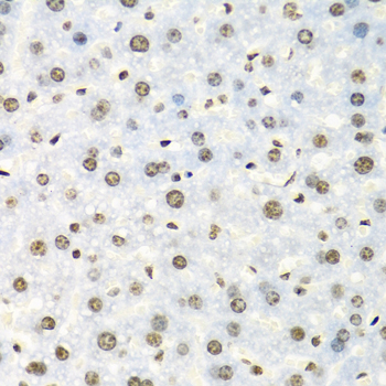 Anti-IGF2BP2 Antibody (CAB2749)