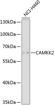 Anti-CAMKK2 Polyclonal Antibody (CAB9899)