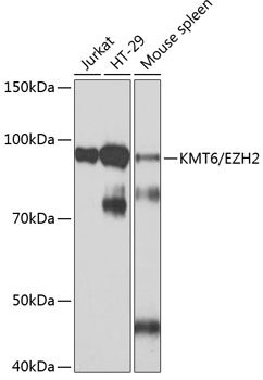 Anti-KMT6 / EZH2 Antibody [KO Validated] (CAB19577)