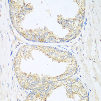 Anti-SGCB Antibody (CAB6979)