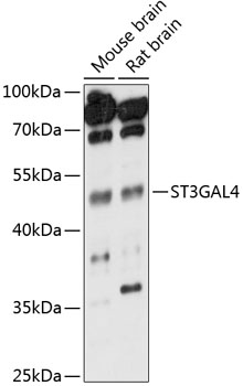 Anti-ST3GAL4 Antibody (CAB14491)