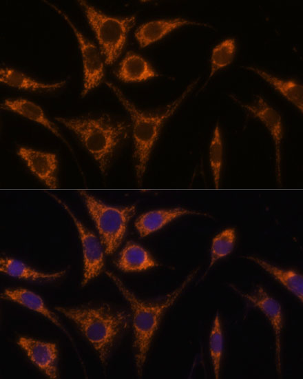 Anti-HSPA13 Antibody (CAB4132)