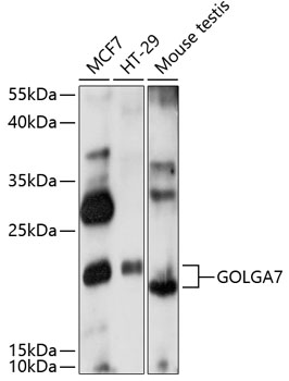 Anti-GOLGA7 Antibody (CAB14888)