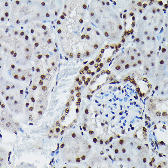 Anti-Phospho-JUN-S73 Antibody (CABP0119)