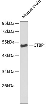 Anti-CTBP1 Antibody (CAB1707)