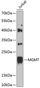 Anti-MGMT Antibody (CAB0052)