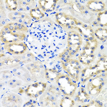 Anti-SCG3 Antibody (CAB7799)