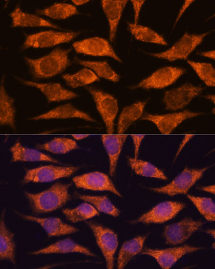 Anti-MRPS14 Antibody (CAB15498)