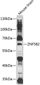 Anti-ZNF582 Antibody (CAB14453)