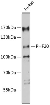 Anti-PHF20 Polyclonal Antibody (CAB9489)