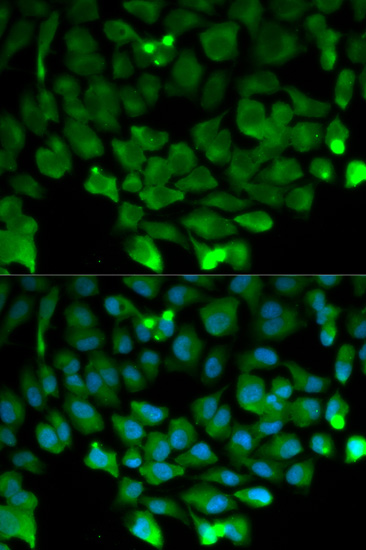 Anti-CUL3 Antibody (CAB1078)