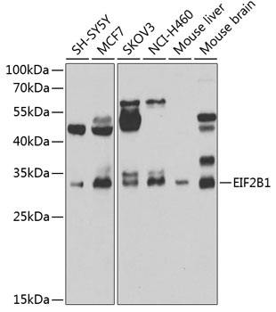 Anti-EIF2B1 Antibody (CAB7892)