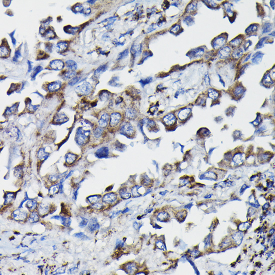 Anti-GSTK1 Antibody (CAB5226)