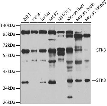 Anti-STK3 Antibody (CAB6992)