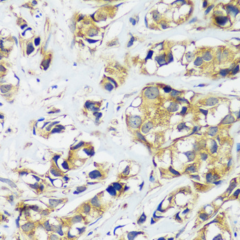 Anti-CCDC124 Antibody (CAB14298)