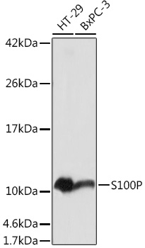 Anti-S100P Antibody (CAB14780)