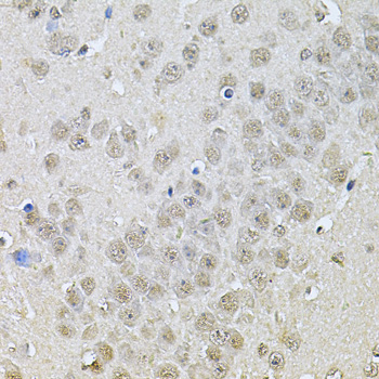 Anti-DR1 Antibody (CAB6903)