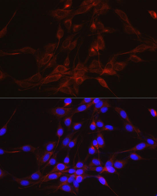 Immunofluorescence analysis of PC-12 cells using GSDMD Rabbit mAb at dilution of 1:100 (40x lens). Blue: DAPI for nuclear staining.