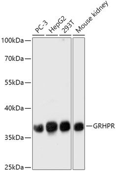 Anti-GRHPR Antibody (CAB17593)
