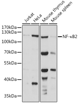 NF-kB2 Rabbit Polyclonal Antibody (CAB15694)