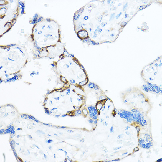 Anti-TMPRSS2 Antibody (CAB1979)