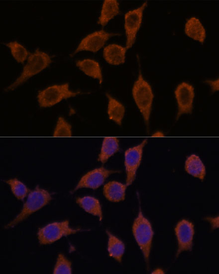 Anti-SEC23IP Antibody (CAB15398)