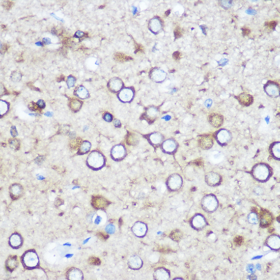 Anti-EYA1 Polyclonal Antibody (CAB9534)