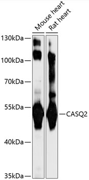 Anti-CASQ2 Antibody (CAB16797)