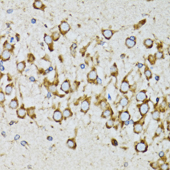 Anti-RPN1 Antibody (CAB12497)